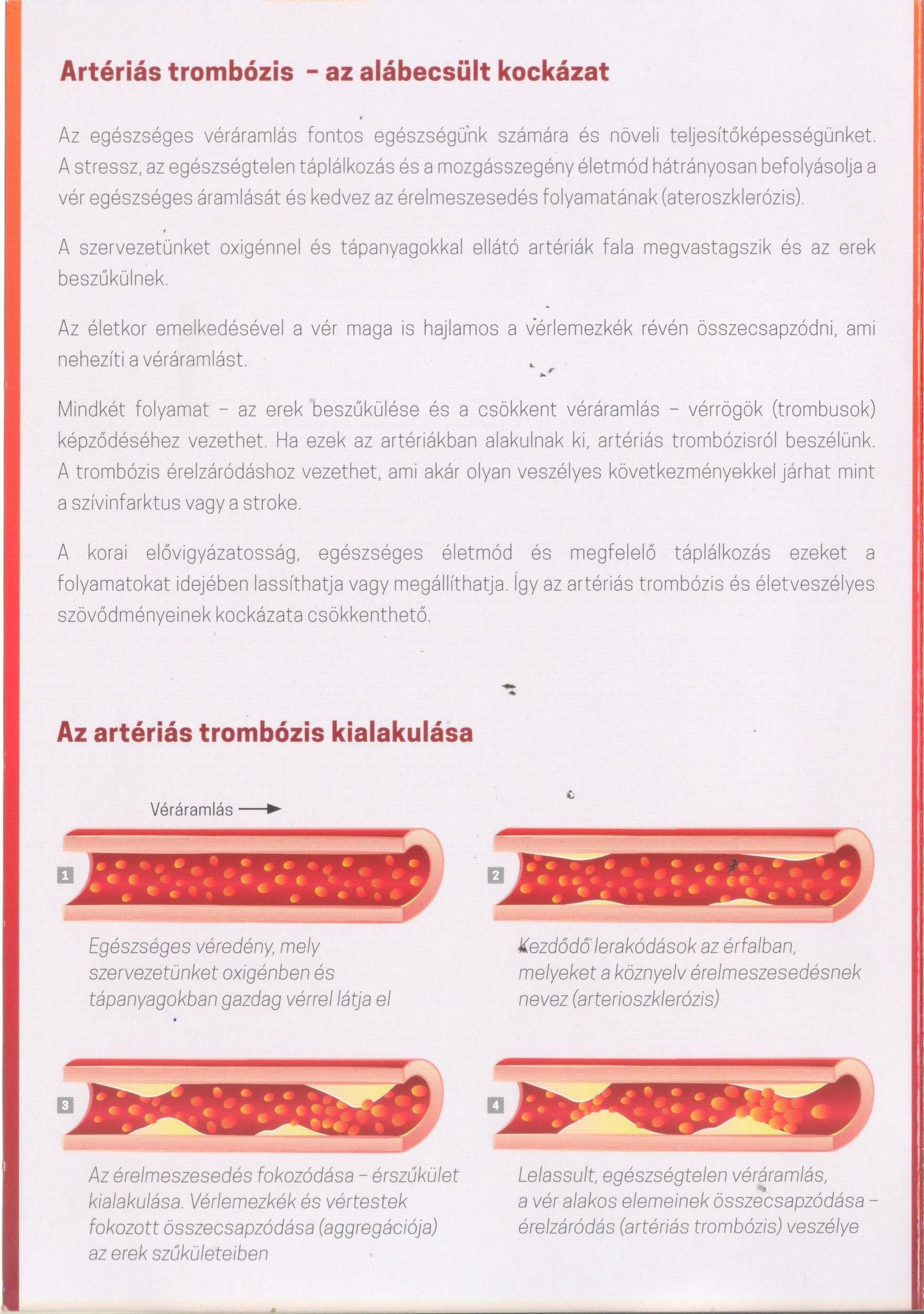 arteriasbetegtajekoztato001a